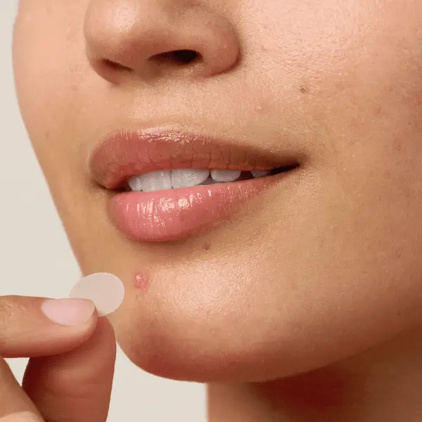 Acne Patches